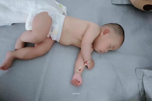 郴州六个月宝宝眼睛散光